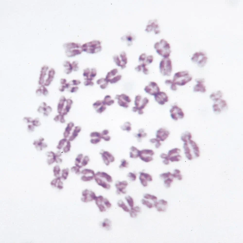 Human Female Chromosomes - 46, XX, spread Microscope Slide
