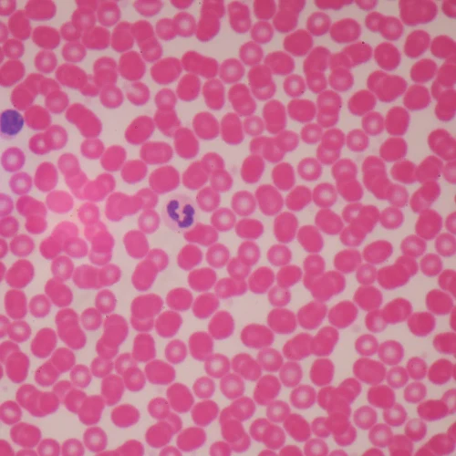 Human Male Blood Film Slide, Smear