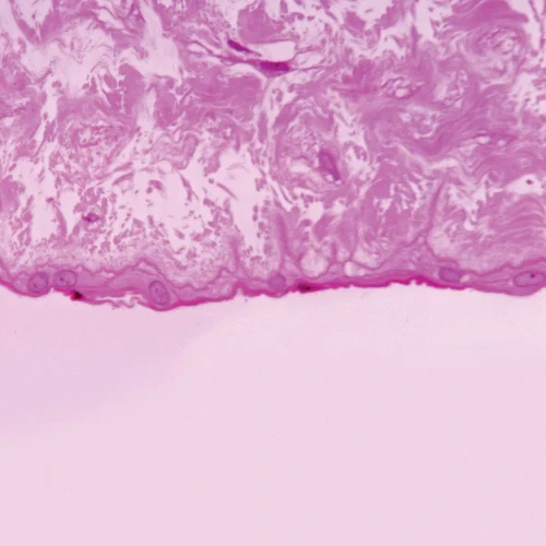 Human Mucous Tissue, c.s., Microscope Slide