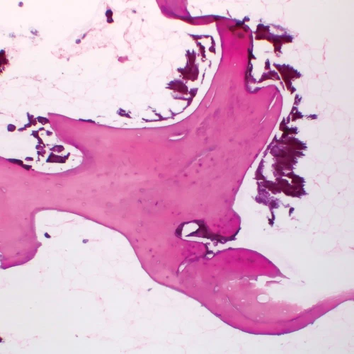 Human Spongy Bone, sec. 7 µm H&E Microscope Slide