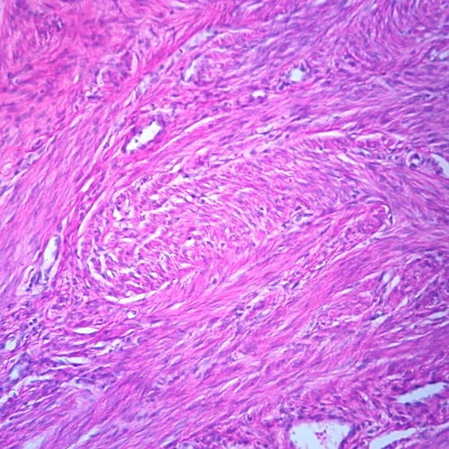 Human Smooth Muscle - Uterus, sec. 7 µm H&E Microscope Slide