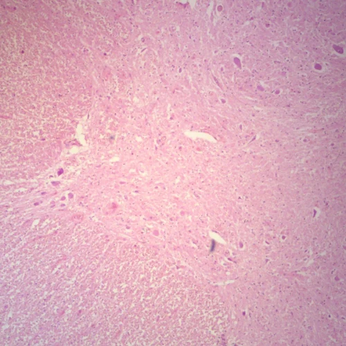 Human Spinal Cord, c.s. 7 µm H&E Microscope Slide
