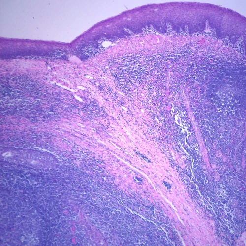 Human Palatine Tonsil sec. 7 µ H&E stain Microscope Slide