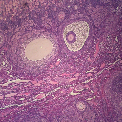 Mammal Graafian Follicles, sec. 7 µm, H&E Microscope Slide