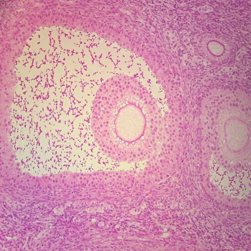 Mammal Graafian Follicles, sec. Microscope Slide, Thin