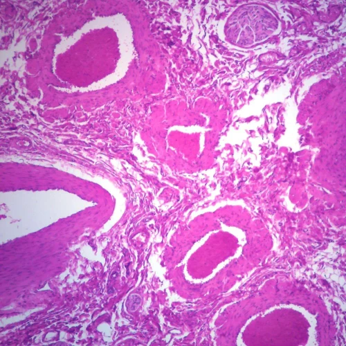 Spermatic Cord, Microscope Slide