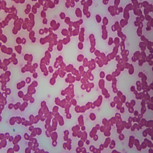 Human Eosinophilia, smear Microscope Slide