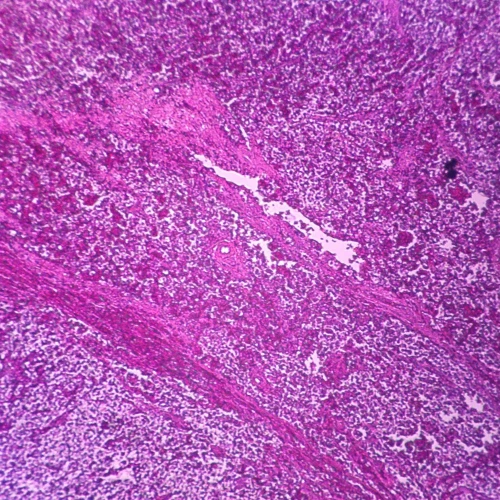 Human Seminoma of Testis Slide, 7 um, H&E