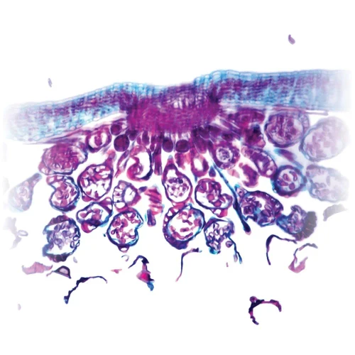 Polypodium Leaflet, section Microscope Slide