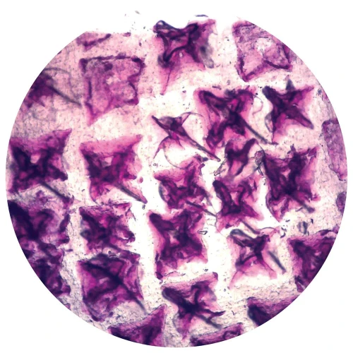 Scales, Dogfish Placoid, w.m., Microscope Slide