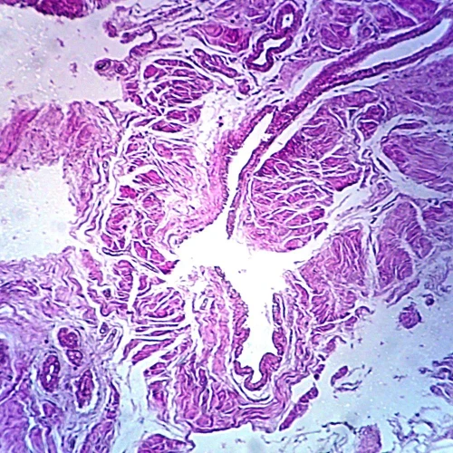 Breast, Senile, Human, section Microscope Slide