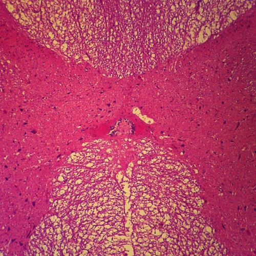 Mammal Spinal Cord Microscope Slides, c.s. 7 µm