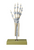 Somso Joints of Hand and Fingers with Ligaments, Anatomical Model