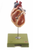 Somso Model of the Heart with Bypass Vessels (Aortic Coronary Venous Bypass)