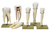 Somso Five Models of Teeth, Anatomical Model