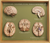 Somso 5 Section Models of the Brain, Anatomical Model