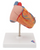 3B Scientific Classic Heart with Left Ventricular Hypertrophy (LVH), 2 part, Anatomical Model