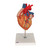 3B Scientific Heart with Bypass, 2 times life size, 4 part, Anatomical Model