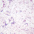 Mixed Gram-Positive and Gram-Negative Bacillus, w.m. Gram Stain Microscope Slide