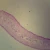 Taenia saginata Mature Proglottid, c.s. 7 µm H&E Microscope Slide