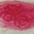 Trichinella spiralis Encysted Larvae, w.m. Microscope Slide