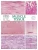 Muscle Tissue, Chart