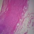 Human Atherosclerosis - Artery, sec. 7 µm H&E Microscope Slide
