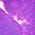 Human Hodgkin's Granuloma, smear Microscope Slide