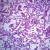 Human Bronchopneumonia, sec. 7 µm H&E Microscope Slide