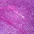 Human Seminoma of Testis Slide, 7 um, H&E
