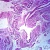 Breast, Senile, Human, section Microscope Slide