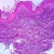 Tattoo, Microscope Slide