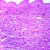 Rocky Mountain Spotted Fever, Skin, section Microscope Slide