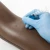 Ultrasound Guided IV Access Arm System Training Package - Light Tone