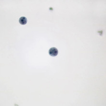 Entamoeba histolytica Cysts, smear Microscope Slide - Southern Biological