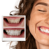 22%CP- Pro Teeth Whitening Gel (8-Gels) SAVE 30% 