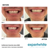 44% Teeth Whitening Gel USA Gel – 15-minutes  (8 Gels) | Expertwhite 