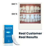 Expertwhite USA Teeth Whitening Strips – 12% Hydrogen Peroxide, Dentist-Grade (28 Strips, 14 Treatments)