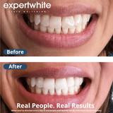 Teeth Whitening Strips 12HP USA  (3 Pack)  | Expertwhite 