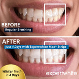 Expertwhite Teeth Whitening FlexWraps -   12% Hydrogen Peroxide, Dentist-Grade (20 Trays, 10 Treatments)