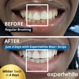 Teeth Whitening Trays 12HP – Max Strength Prefilled Whitening (3 Pack) – Expertwhite