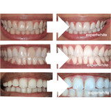 Expertwhite WhiteBoost™ USA Peroxide Toothpaste Booster Gel