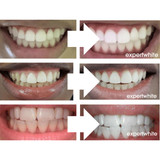 Teeth Whitening Gel 16 Carbamide Peroxide - Sensitive Teeth | Expertwhite 