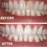 Expertwhite USA Ultra+Whitening Pen