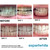 Expertwhite 35% LED Teeth Whitening Kit (35% Carbamide Peroxide Gel)