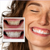  22%CP- Pro Teeth Whitening Gel  (20-Gels) SAVE 50%