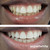 Expertwhite Peroxide Toothpaste Booster Gel. 