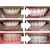 Teeth Whitening Gel 16 Carbamide Peroxide - Sensitive Teeth | Expertwhite 