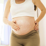 How to Get rid of Stretch Marks after Pregnancy or Weight Loss How to Get rid of Stretch Marks after Pregnancy or Weight Loss