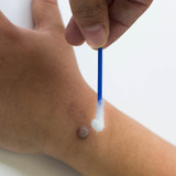 How to Get Rid of Warts How to Get Rid of Warts